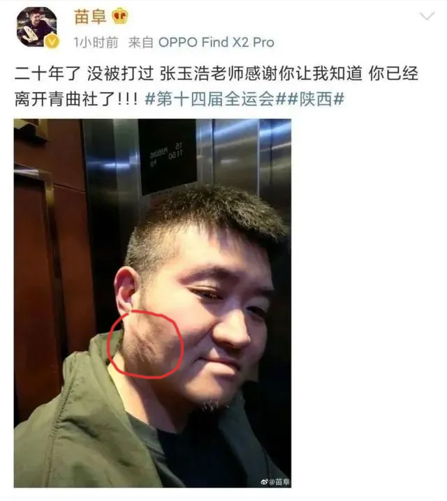 苗阜发微自爆被打后秒删，打人者张玉浩发微“因果有循环” 相声新势力 青曲社 相声 张玉浩 苗阜 3030说  第1张